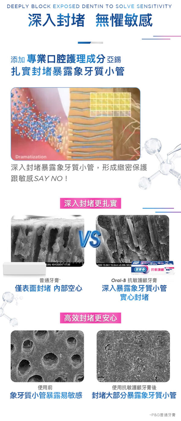【合康連鎖藥局】歐樂B抗敏護齦牙膏 90g-極速抗敏：圖片 7
