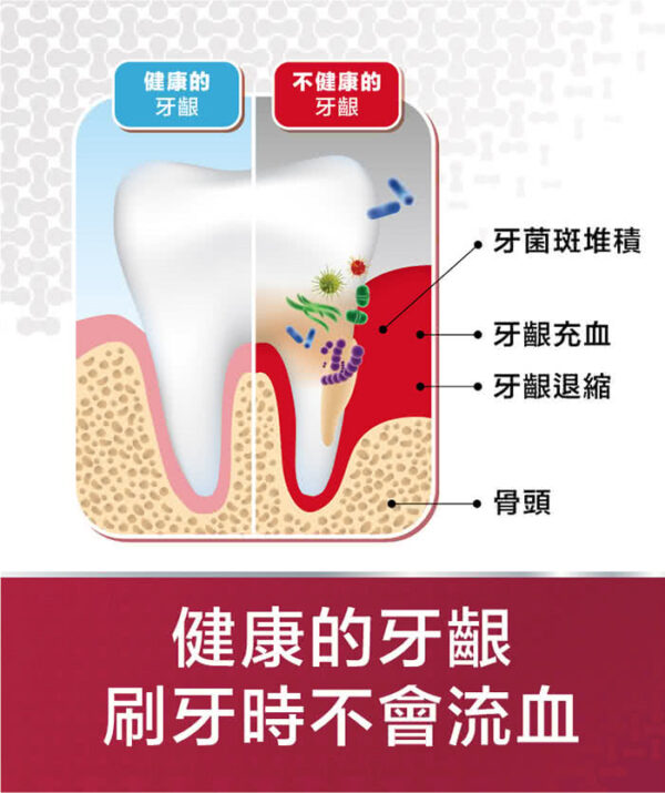 【合康連鎖藥局】牙周適牙齦護理牙膏90g-經典配方：圖片 3